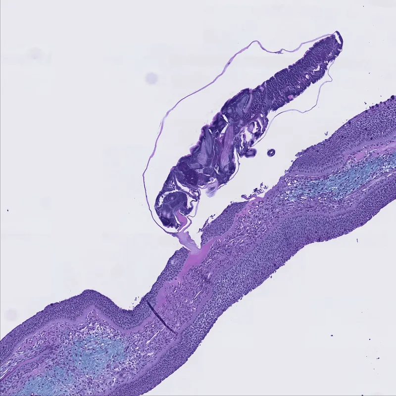 A microscope photo of a sealouce attaching to a fish.